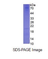Eukaryotic Sex Hormone Binding Globulin (SHBG)