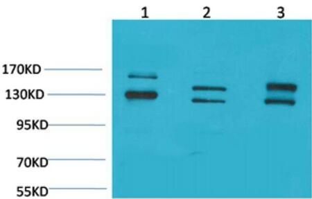 BAI1 Polyclonal Antibody