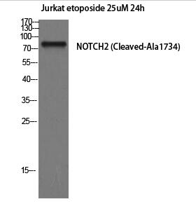 Cleaved-Notch 2 (A1734) Polyclonal Antibody