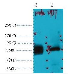 ABCB5 Monoclonal Antibody