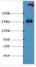 EGFR Monoclonal Antibody