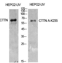Cortactin (Acetyl Lys235) Polyclonal Antibody