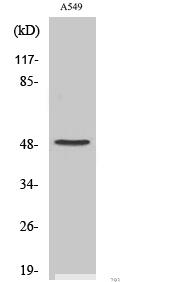 Cleaved-Factor X/ Factor X LC (A41) Polyclonal Antibody