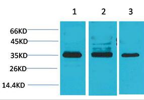 L-type Ca++ CP γ4 Polyclonal Antibody