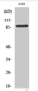 Cleaved-Integrin αV HC (K889) Polyclonal Antibody
