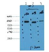 CK7 Monoclonal Antibody