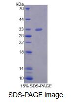 Recombinant Mediator Complex Subunit 6 (MED6)