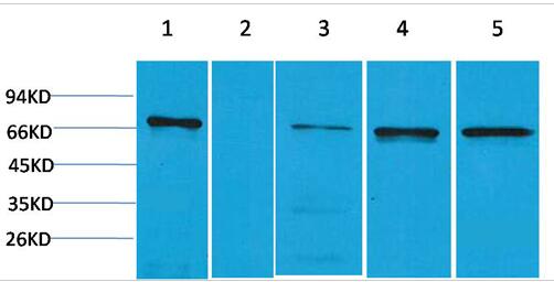 ZBTB45 Polyclonal Antibody