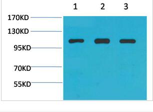 Actinin-α1 Polyclonal Antibody