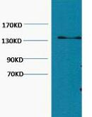 Collagen III Monoclonal Antibody