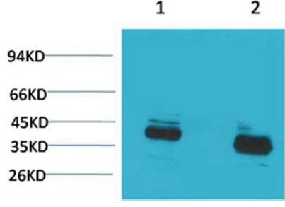 CABP Polyclonal Antibody