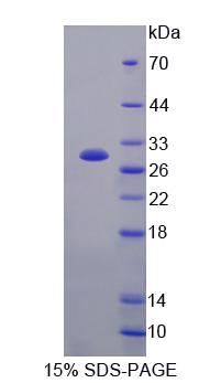 Recombinant Histocompatibility HA1, Minor (HMHA1)