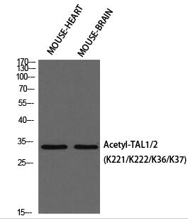 TAL1/2 (Acetyl Lys221/Acetyl Lys222/Acetyl Lys36/Acetyl Lys37) Polyclonal Antibo