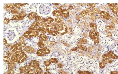 IL-8 Mouse Monoclonal Antibody(8B1)