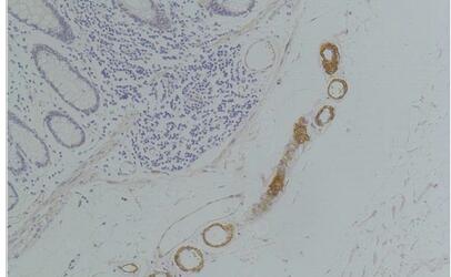 GRIK2 (GluR6) Polyclonal Antibody