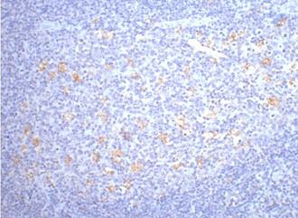 IHC staining of human tonsil tissue, diluted at 1:200.