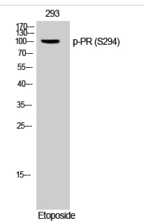 PR (phospho Ser294) Polyclonal Antibody