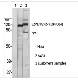 EphB1/2 (phospho Tyr594/604) Polyclonal Antibody