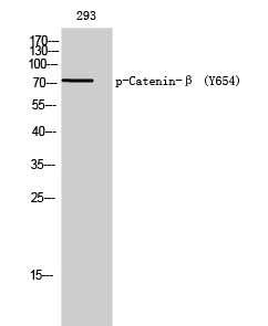 Western Blot analysis of 293 cells using Phospho-Catenin-β (Y654) Polyclonal Ant