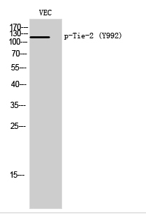 Tie-2 (phospho Tyr992) Polyclonal Antibody