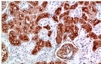 CD10 Rabbit Polyclonal Antibody