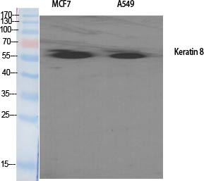 Cytokeratin 8 Polyclonal Antibody