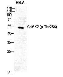 CaMKIIα/δ (phospho Thr286) Polyclonal Antibody
