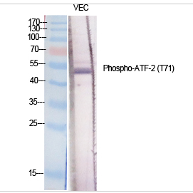ATF-2 (phospho Thr71) Polyclonal Antibody