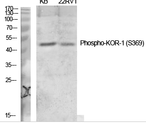 KOR-1 (phospho Ser369) Polyclonal Antibody
