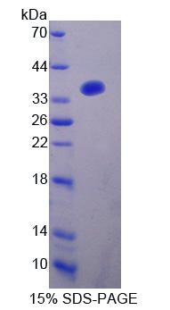 Recombinant A Kinase Anchor Protein 12 (AKAP12)