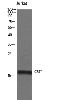Cystatin SN Polyclonal Antibody