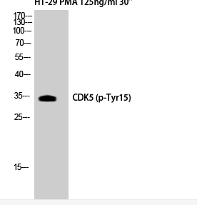 Cdk5 (phospho Tyr15) Polyclonal Antibody