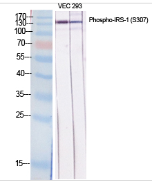 IRS-1 (phospho Ser307) Polyclonal Antibody