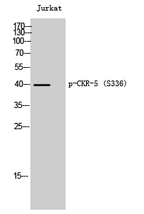 CKR-5 (phospho Ser336) Polyclonal Antibody