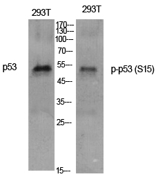 p53 (phospho Ser15) Polyclonal Antibody