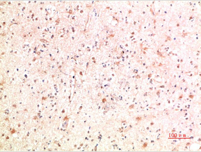 PI3 Kinase P85 Rabbit Polyclonal Antibody