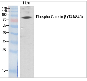 Catenin-β (phospho Thr41/S45) Polyclonal Antibody