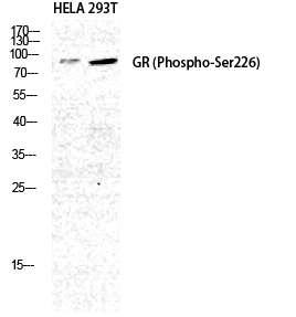 GR (phospho Ser226) Polyclonal Antibody