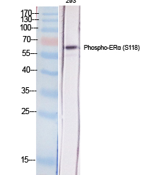 ERα (phospho Ser118) Polyclonal Antibody