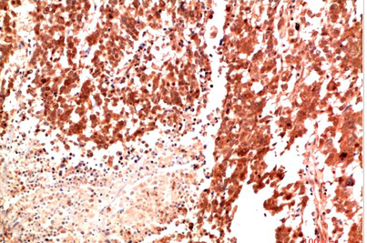 Met Rabbit Polyclonal Antibody