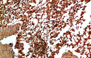 JNK2 Rabbit Polyclonal Antibody