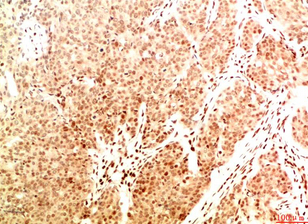 Acetyl NF kB P65（K314/K315) Mouse Monoclonal Antibody(2A11)