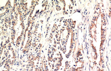 CHOP Mouse Monoclonal Antibody(2B1)