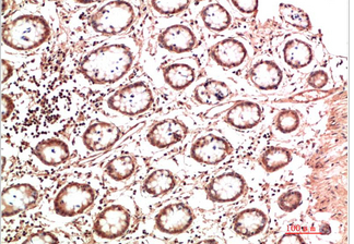 Collagen II Mouse Monoclonal Antibody(7F9)
