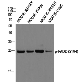 FADD (phospho Ser194) Polyclonal Antibody