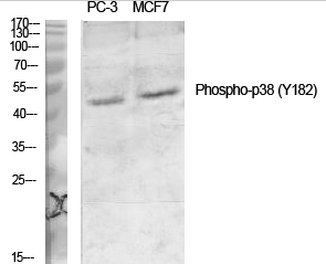 p38 (phospho Tyr182) Polyclonal Antibody
