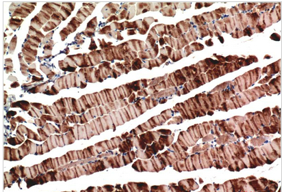 Muscle actin Mouse Monoclonal Antibody(3E9)
