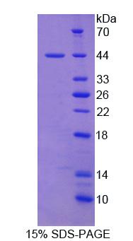 Recombinant Absent In Melanoma 2 (AIM2)