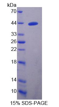 Recombinant A Disintegrin And Metalloproteinase With Thrombospondin 16 (ADAMTS16