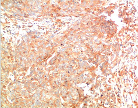 ATG7 Mouse Monoclonal Antibody(3D6)